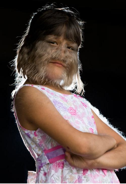 worlds-hairiest-girl